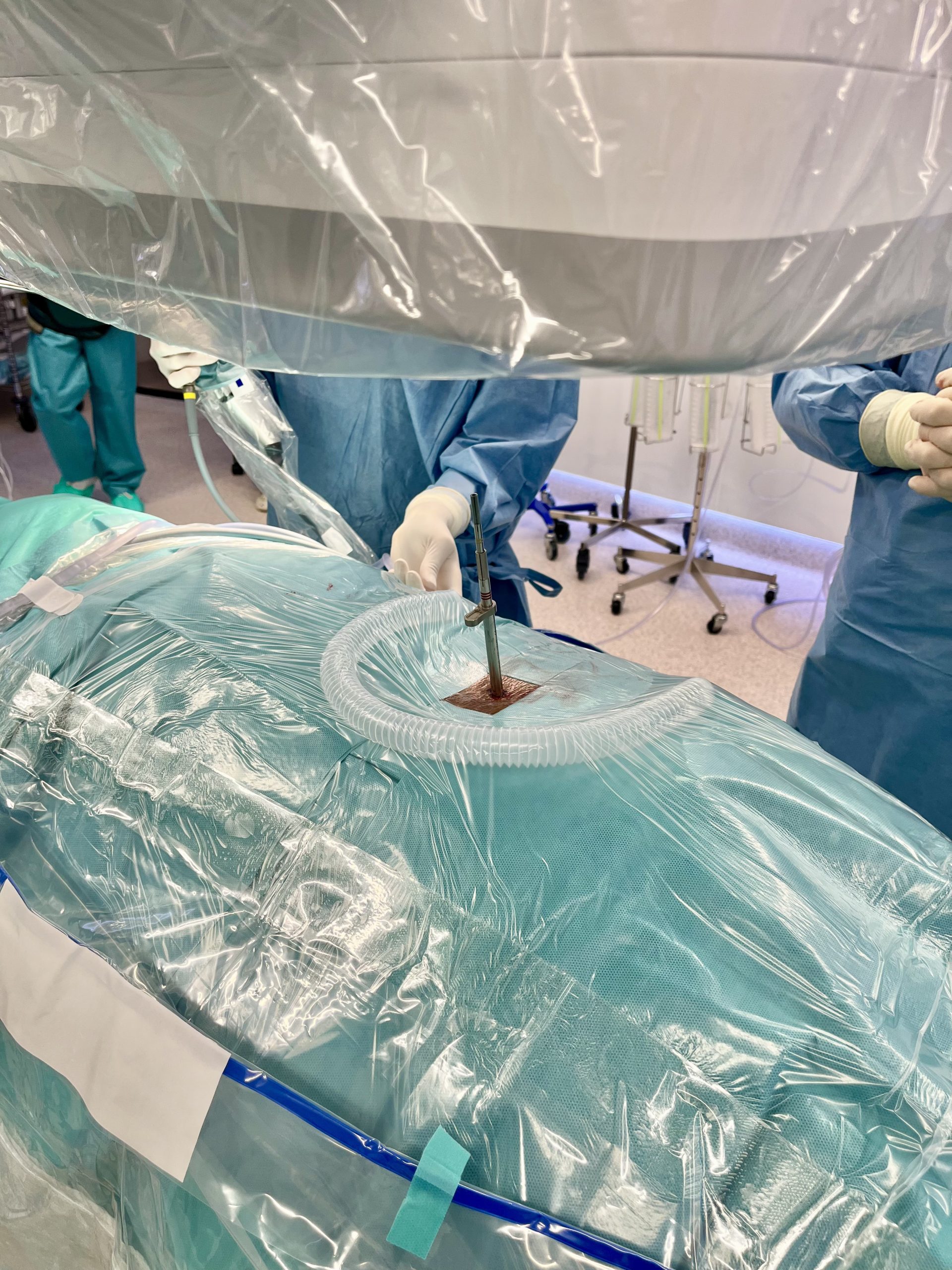 Endoscopia de Columna en Barcelona